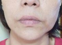 PAO�̌���(After)